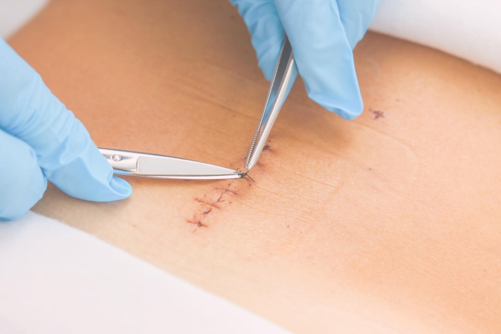 Kraamvrouw in bed terwijl verloskundige hechtingen controleert na bevalling